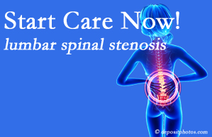 Young Chiropractic shares research that emphasizes that non-operative treatment for spinal stenosis within a month of diagnosis is beneficial. 