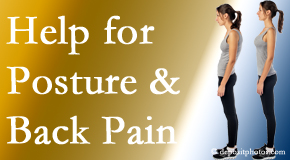 Poor posture and back pain are linked and find help and relief at Young Chiropractic.