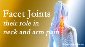 Young Chiropractic carefully examines, diagnoses, and treats cervical spine facet joints for neck pain relief when they are involved.