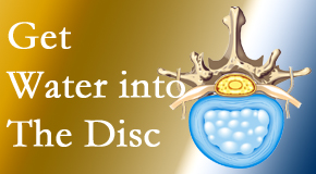 Young Chiropractic uses spinal manipulation and exercise to enhance the diffusion of water into the disc which helps the health of the disc.
