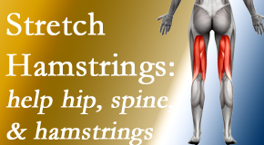 Young Chiropractic promotes back pain patients to stretch hamstrings for length, range of motion and flexibility to support the spine.