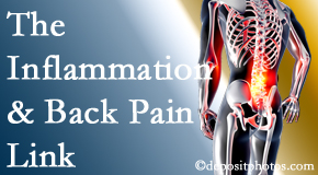 Young Chiropractic addresses the inflammatory process that accompanies back pain as well as the pain itself.