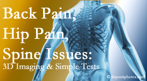 Young Chiropractic examines back pain patients for various issues like back pain and hip pain and other spine issues with imaging and clinical tests that influence a relieving chiropractic treatment plan.
