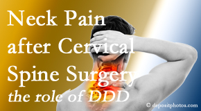 Young Chiropractic offers gentle treatment for neck pain after neck surgery.