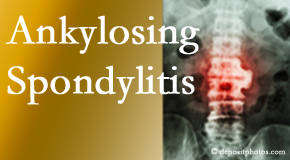 Ankylosing spondylitis is gently cared for by your Easley chiropractor.