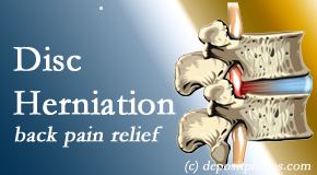 Young Chiropractic offers non-surgical treatment for relief of disc herniation related back pain. 