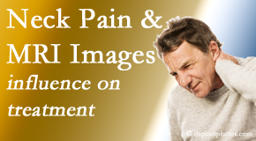 Young Chiropractic considers MRI findings like Modic Changes when setting up a neck pain relieving treatment plan.