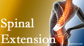 Young Chiropractic understands the role of extension in spinal motion, its necessity, its benefits and potential harmful effects. 