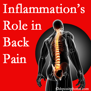 The role of inflammation in Easley back pain is real. Chiropractic care can help.