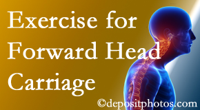 Easley chiropractic treatment of forward head carriage is two-fold: manipulation and exercise.