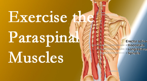 Young Chiropractic describes the importance of paraspinal muscles and their strength for Easley back pain relief.