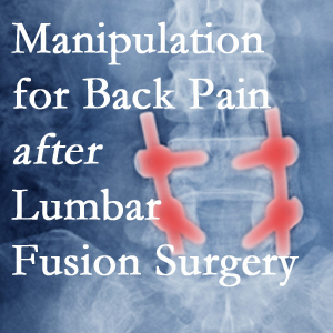 Easley chiropractic spinal manipulation helps post-surgical continued back pain patients discover relief of their pain despite fusion. 