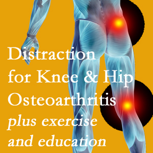 A chiropractic treatment plan for Easley knee pain and hip pain caused by osteoarthritis: education, exercise, distraction.