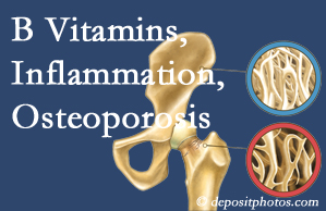 Easley chiropractic care of osteoporosis often comes with nutritional tips like b vitamins for inflammation reduction and for prevention.