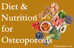 Easley osteoporosis prevention tips from your chiropractor include improved diet and nutrition and reduced sodium, bad fats, and sugar intake. 