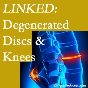 Degenerated discs and degenerated knees are not such strange bedfellows. They are seen to be related. Easley patients with a loss of disc height due to disc degeneration often also have knee pain related to degeneration. 